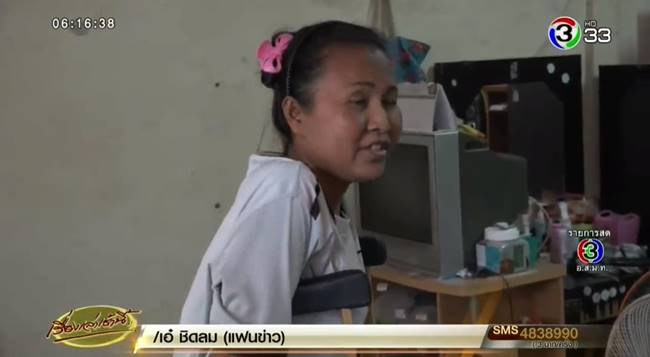 เหยียบคนไข้ขาหัก เหยียบคนไข้ขาหัก