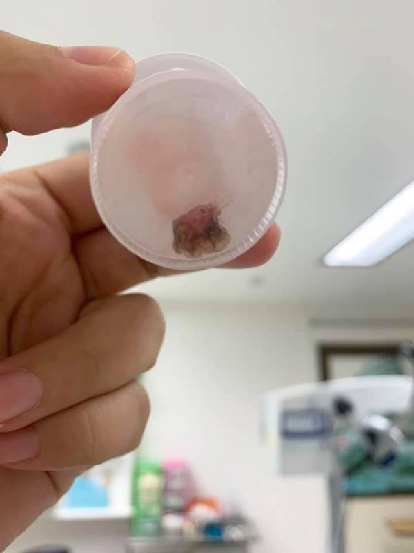 พยาธิ พยาธิ