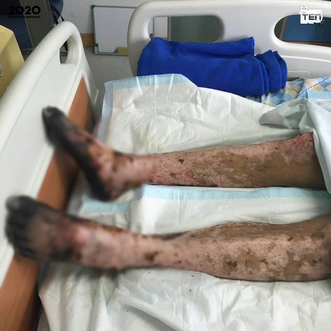 หลู้หมูดิบ หลู้หมูดิบ