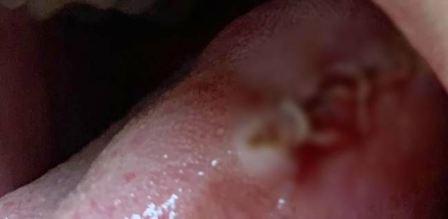 พยาธิ พยาธิ