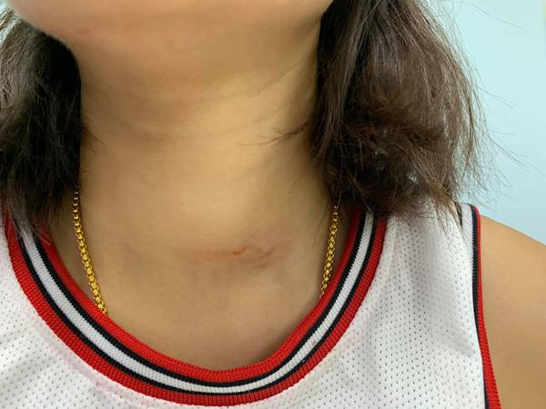 เตือนภัยผู้หญิง เตือนภัยผู้หญิง