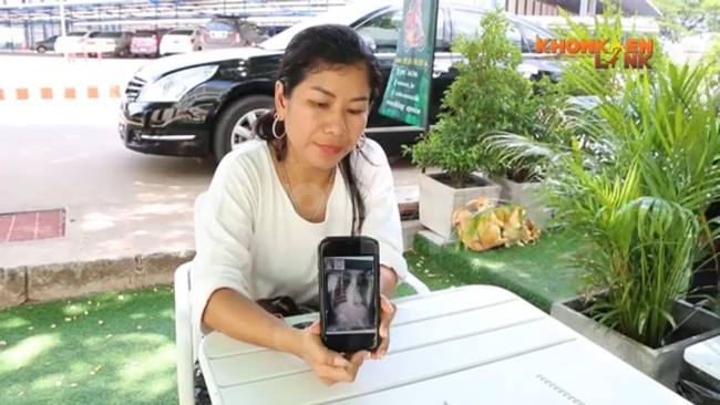 กระดูกสันหลังคดงอ กระดูกสันหลังคดงอ