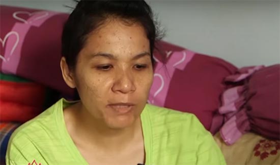 ผ่าตัดนิ่ว แต่กลับเสียไต 1 ข้าง ผ่าตัดนิ่ว แต่กลับเสียไต 1 ข้าง