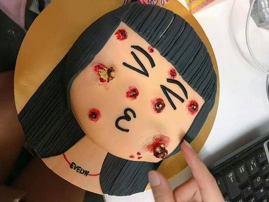 เค้กบีบสิว เค้กบีบสิว