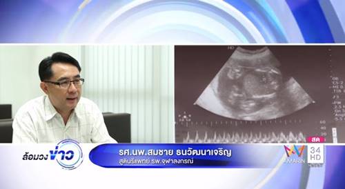 วินิจฉัยท้องแฝดผิดพลาด วินิจฉัยท้องแฝดผิดพลาด