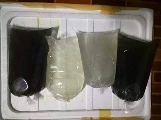 สาธารณสุข ชี้ บ่อน้ำดำที่นราธิวาส พบสารรักษาโรคผิวหนังได้ สาธารณสุข ชี้ บ่อน้ำดำที่นราธิวาส พบสารรักษาโรคผิวหนังได้