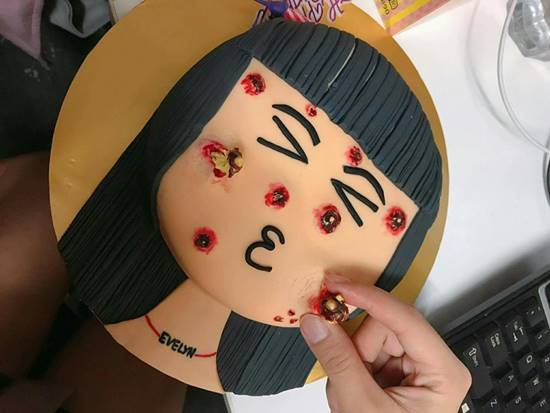 เค้กบีบสิว เค้กบีบสิว