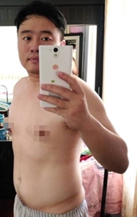 เปิดใจคุณพ่ออ้วน 100 กก. เปิดใจคุณพ่ออ้วน 100 กก.