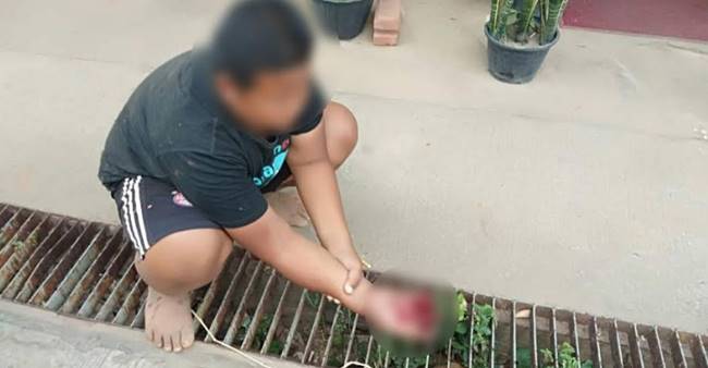 เด็กนิ้วขาด เด็กนิ้วขาด