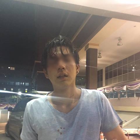 ระอุโซเชียล ! เที่ยวผับบางแสน ถูกเจ้าของร้านและลูกน้องรุมสกรัม เย็บ 16 เข็ม ระอุโซเชียล ! เที่ยวผับบางแสน ถูกเจ้าของร้านและลูกน้องรุมสกรัม เย็บ 16 เข็ม