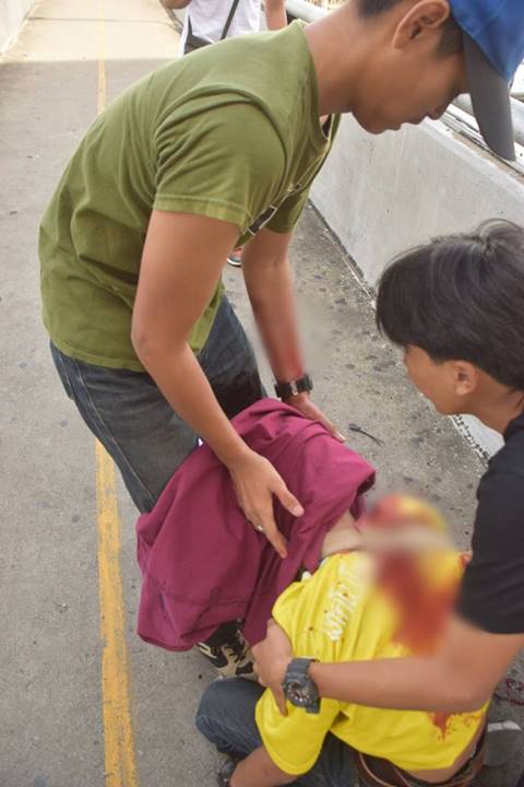 ดุเดือด อาชีวะยกพวกตีกันป้ายรถเมล์ รังสิต คนหนีกระเจิง-โดนฟันเลือดอาบ ดุเดือด อาชีวะยกพวกตีกันป้ายรถเมล์ รังสิต คนหนีกระเจิง-โดนฟันเลือดอาบ