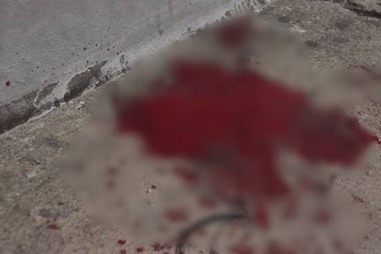 ดุเดือด อาชีวะยกพวกตีกันป้ายรถเมล์ รังสิต คนหนีกระเจิง-โดนฟันเลือดอาบ ดุเดือด อาชีวะยกพวกตีกันป้ายรถเมล์ รังสิต คนหนีกระเจิง-โดนฟันเลือดอาบ