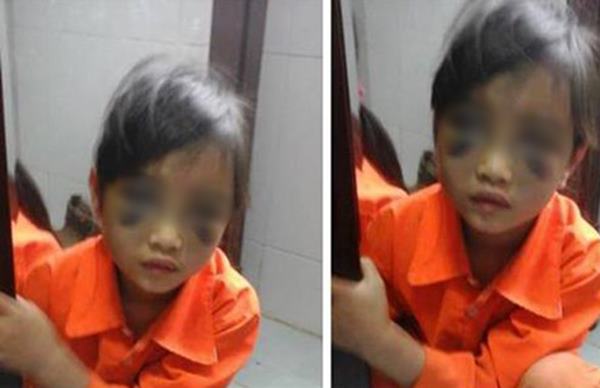 ครูโหดฟาดไม้บรรทัดเข้าเบ้าตาเด็กจนดำช้ำ เหตุแค่สะกดคำผิด ครูโหดฟาดไม้บรรทัดเข้าเบ้าตาเด็กจนดำช้ำ เหตุแค่สะกดคำผิด