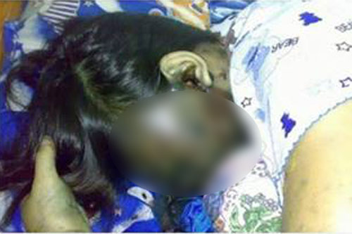 ภาพสาวฟิลิปปินส์ตายเพราะไฟวิ่งผ่านหูฟัง ที่แท้ข่าวมั่ว ภาพสาวฟิลิปปินส์ตายเพราะไฟวิ่งผ่านหูฟัง ที่แท้ข่าวมั่ว