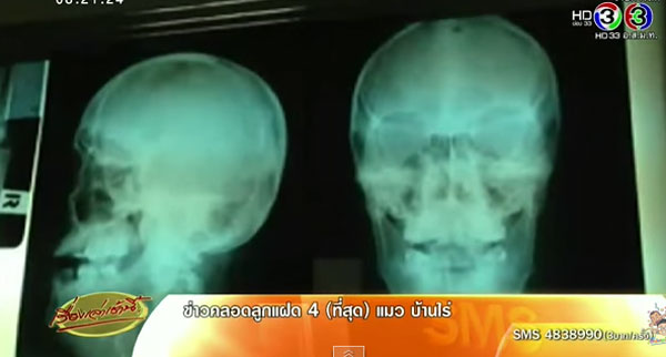 อัพเดท อาการหลวงตาจันทร์ ถูกเสือตะปบ ย้ำเป็นอุบัติเหตุ-ไม่มีเหตุผลที่เสือจะทำร้าย อัพเดท อาการหลวงตาจันทร์ ถูกเสือตะปบ ย้ำเป็นอุบัติเหตุ-ไม่มีเหตุผลที่เสือจะทำร้าย