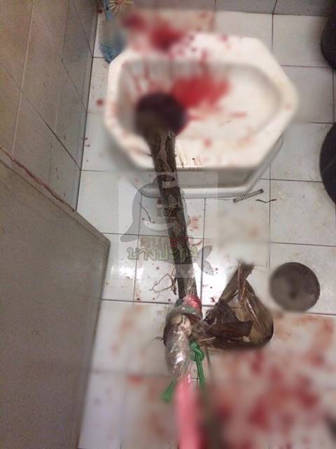 สยองหนักมาก งูเหลือมพุ่งจากคอห่านงับเจ้าโลกหนุ่ม อาการสาหัส สยองหนักมาก งูเหลือมพุ่งจากคอห่านงับเจ้าโลกหนุ่ม อาการสาหัสสยองหนักมาก งูเหลือมพุ่งจากคอห่านงับเจ้าโลกหนุ่ม อาการสาหัส