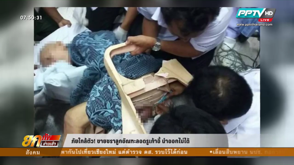 ชายไม่ใส่กางเกงใน ลูกอัณฑะติดในร่องเก้าอี้ ชายไม่ใส่กางเกงใน ลูกอัณฑะติดในร่องเก้าอี้