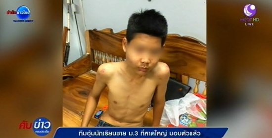 มอบตัวแล้ว ! ทีมอุ้มทำร้ายเด็ก ม.3 ซี่โครงหัก ชนวนเหตุจากเรื่องรักวัยรุ่น มอบตัวแล้ว ! ทีมอุ้มทำร้ายเด็ก ม.3 ซี่โครงหัก ชนวนเหตุจากเรื่องรักวัยรุ่น
