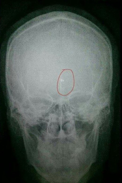 แร็พเปอร์ดวงแข็งถูกยิงเลือดอาบ ยังมีแก่ใจถ่ายคลิปเซลฟี่อวดเฟซบุ๊ก แร็พเปอร์ดวงแข็งถูกยิงเลือดอาบ ยังมีแก่ใจถ่ายคลิปเซลฟี่อวดเฟซบุ๊ก