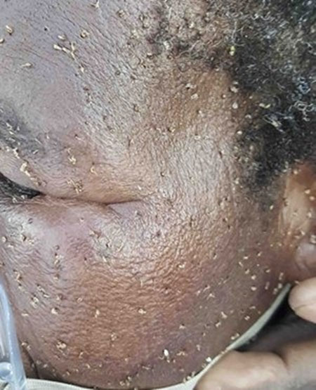 สยอง หญิงถูกผึ้งรุมต่อยชุดใหญ่ ฝากเหล็กในไว้นับพัน สยอง หญิงถูกผึ้งรุมต่อยชุดใหญ่ ฝากเหล็กในไว้นับพัน