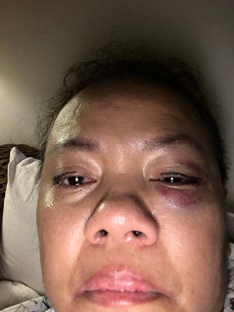 เจ้าของร้านอาหาร ร้องถูกคนอ้างตัวเป็นเจ้าหน้าที่ลิขสิทธิ์ทำร้าย เจ้าของร้านอาหาร ร้องถูกคนอ้างตัวเป็นเจ้าหน้าที่ลิขสิทธิ์ทำร้าย