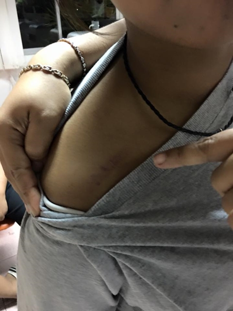 เจ้าของร้านอาหาร ร้องถูกคนอ้างตัวเป็นเจ้าหน้าที่ลิขสิทธิ์ทำร้าย เจ้าของร้านอาหาร ร้องถูกคนอ้างตัวเป็นเจ้าหน้าที่ลิขสิทธิ์ทำร้าย