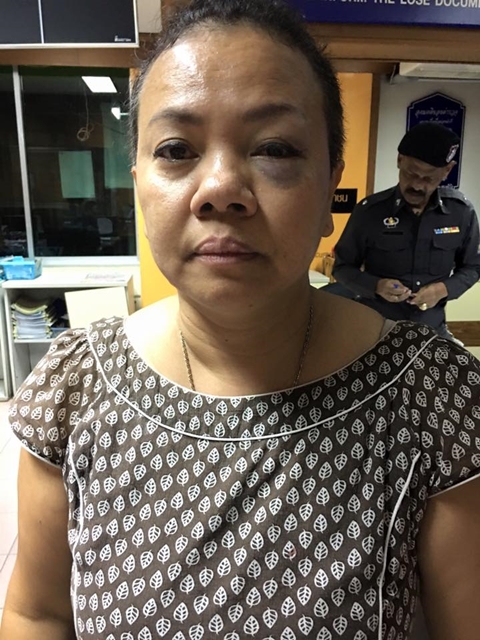 เจ้าของร้านอาหาร ร้องถูกคนอ้างตัวเป็นเจ้าหน้าที่ลิขสิทธิ์ทำร้าย เจ้าของร้านอาหาร ร้องถูกคนอ้างตัวเป็นเจ้าหน้าที่ลิขสิทธิ์ทำร้าย