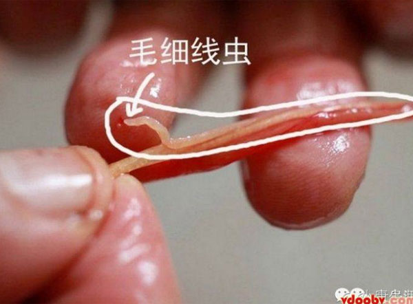 พยาธิตัวจี้ด ภัยร้ายที่ซ่อนตัวในปลาไหล ที่แม้แต่ความร้อนยังฆ่าไม่ตาย พยาธิตัวจี้ด ภัยร้ายที่ซ่อนตัวในปลาไหล ที่แม้แต่ความร้อนยังฆ่าไม่ตาย