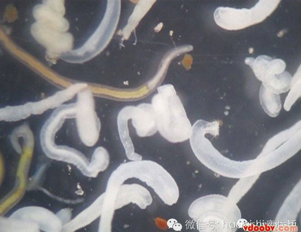 พยาธิตัวจี้ด ภัยร้ายที่ซ่อนตัวในปลาไหล ที่แม้แต่ความร้อนยังฆ่าไม่ตาย พยาธิตัวจี้ด ภัยร้ายที่ซ่อนตัวในปลาไหล ที่แม้แต่ความร้อนยังฆ่าไม่ตาย