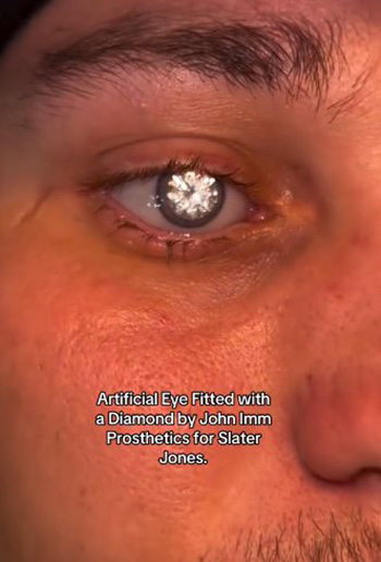 หนุ่มตาเพชร หนุ่มตาเพชร