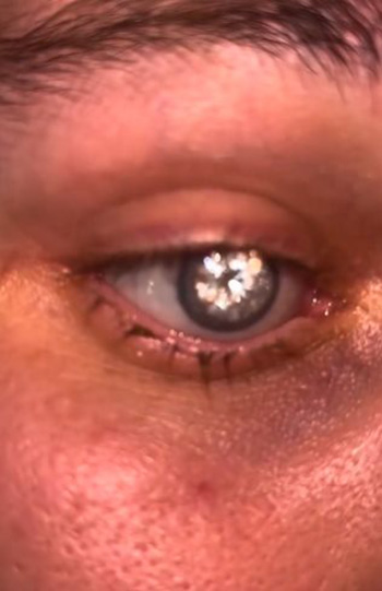 หนุ่มตาเพชร หนุ่มตาเพชร