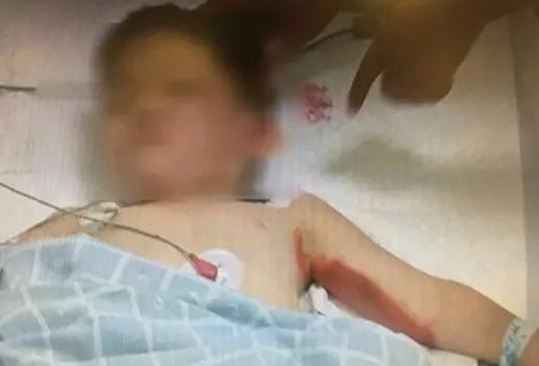 ขับรถเหยียบเด็ก ขับรถเหยียบเด็ก