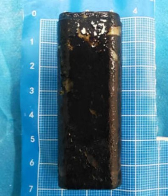 หมอพบวัตถุปริศนาสีดำในท้องคนไข้ หมอพบวัตถุปริศนาสีดำในท้องคนไข้