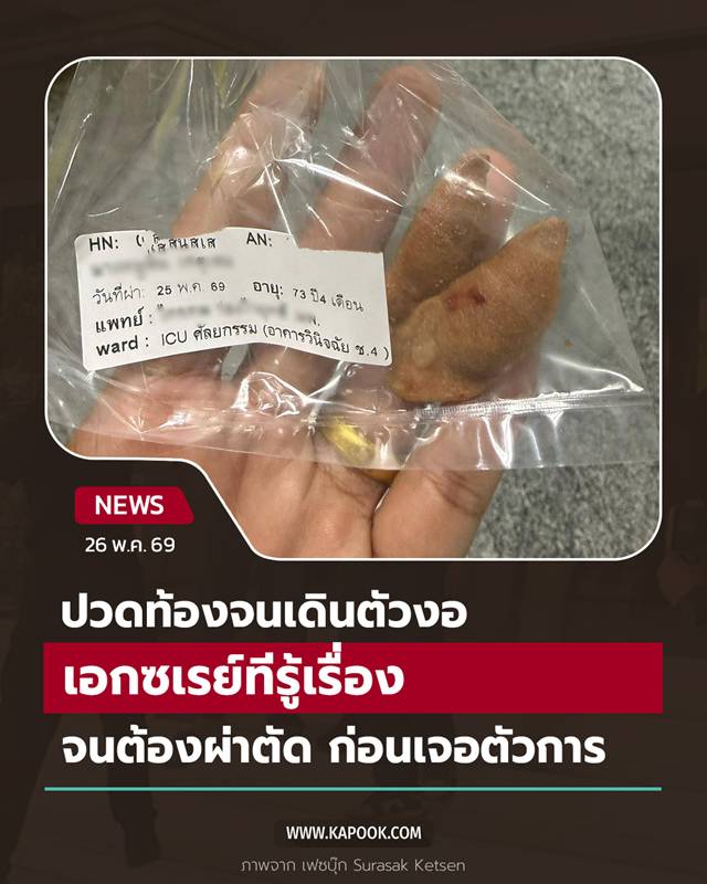 ปวดท้อง ปวดท้อง