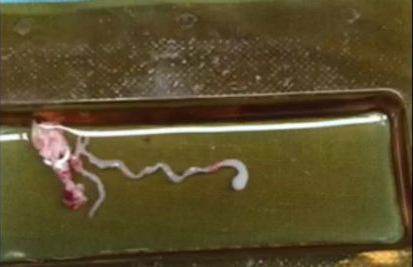 พยาธิ พยาธิ