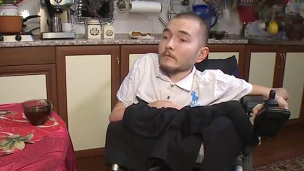 หนุ่มรัสเซียขออาสา เป็นคนไข้ทดลองผ่าตัดเปลี่ยนศีรษะคนแรกของโลก หนุ่มรัสเซียขออาสา เป็นคนไข้ทดลองผ่าตัดเปลี่ยนศีรษะคนแรกของโลก