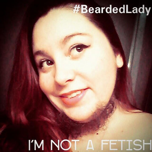 ชีวิตดี๊ดี ๆ ของสาวเคราเฟิ้ม แฟนบอกรักเสมอ แม้ขนรกหน้า ชีวิตดี๊ดี ๆ ของสาวเคราเฟิ้ม แฟนบอกรักเสมอ แม้ขนรกหน้า