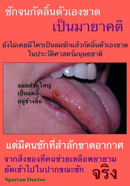ชักจนกัดลิ้นขาด ไม่เคยมี ชักจนกัดลิ้นขาด ไม่เคยมี