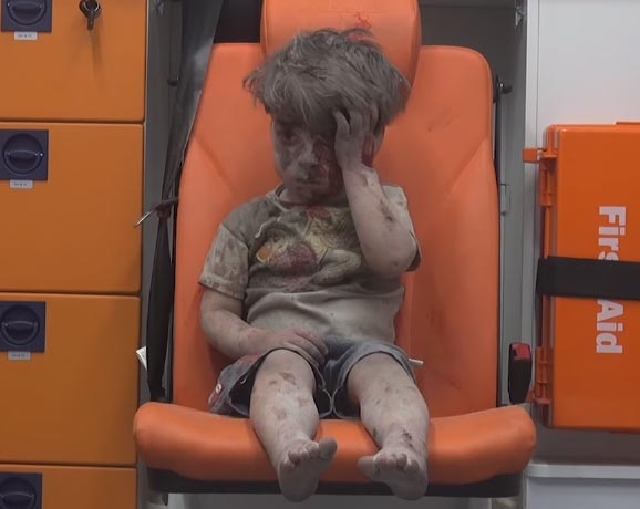 เด็กชาย 5 ขวบบาดเจ็บ-แววตาใสซื่อ ภาพสะท้อนเหยื่อบริสุทธิ์แห่งสงครามซีเรีย เด็กชาย 5 ขวบบาดเจ็บ-แววตาใสซื่อ ภาพสะท้อนเหยื่อบริสุทธิ์แห่งสงครามซีเรีย