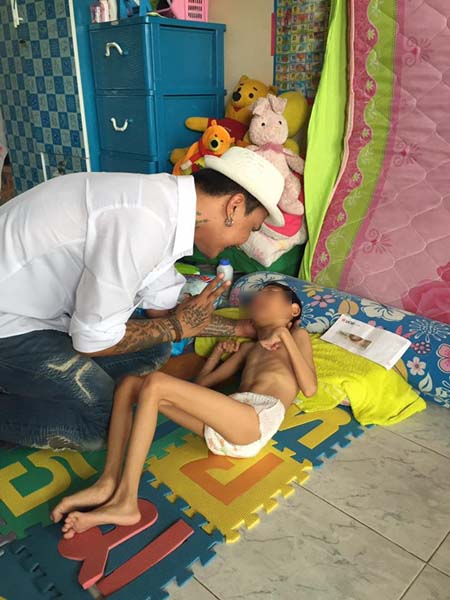 เด็ก 8 ขวบ หนัก 10 กิโลกรัม ป่วยสมองพิการ เด็ก 8 ขวบ หนัก 10 กิโลกรัม ป่วยสมองพิการ