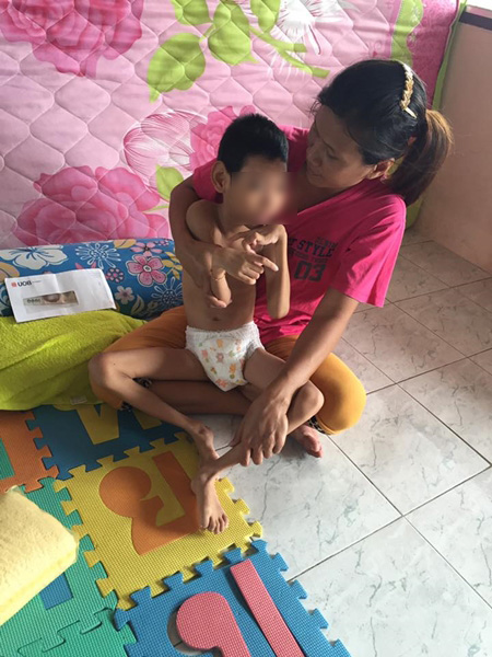 เด็ก 8 ขวบ หนัก 10 กิโลกรัม ป่วยสมองพิการ เด็ก 8 ขวบ หนัก 10 กิโลกรัม ป่วยสมองพิการ