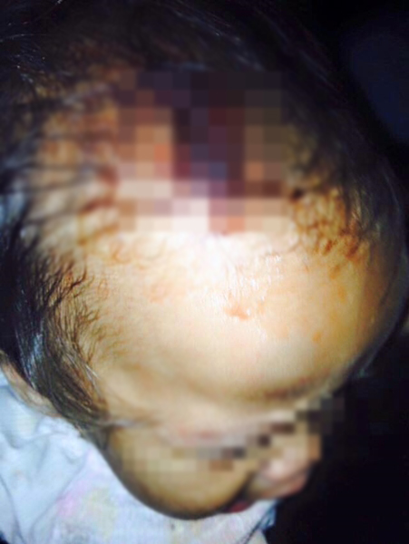 แม่-น้องเขย ทะเลาะกัน สู้ไม่ได้มาลงที่เด็ก แม่-น้องเขย ทะเลาะกัน สู้ไม่ได้มาลงที่เด็ก