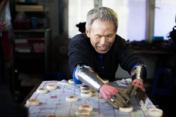 แขนเทียม แขนเทียม