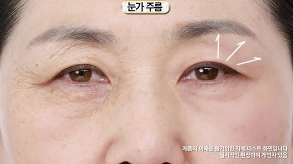 นวัตกรรมเสริมความงามชิ้นใหม่จากเกาหลี Lifting Stick นวัตกรรมเสริมความงามชิ้นใหม่จากเกาหลี Lifting Stick