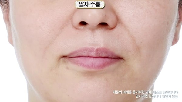 นวัตกรรมเสริมความงามชิ้นใหม่จากเกาหลี Lifting Stick นวัตกรรมเสริมความงามชิ้นใหม่จากเกาหลี Lifting Stick