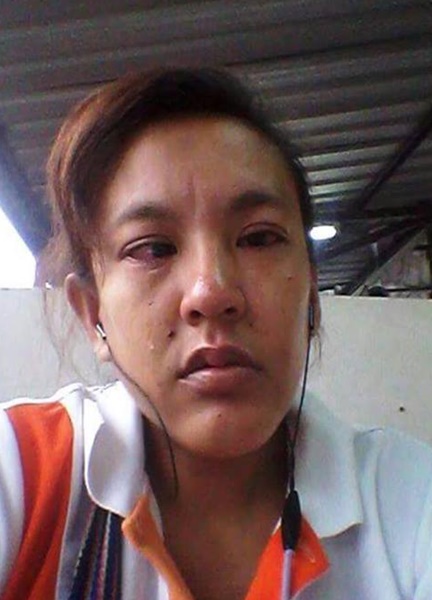 ดวงตา ตลกตาเหร่ ดวงตา ตลกตาเหร่