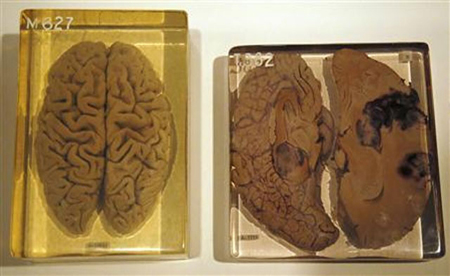 10 ความอัศจรรย์ชวนรู้ของสมองที่คุณต้องทึ่ง 10 ความอัศจรรย์ชวนรู้ของสมองที่คุณต้องทึ่ง