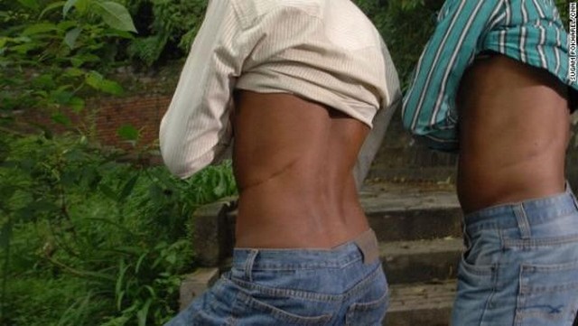 หมู่บ้านขายไต หมู่บ้านขายไต