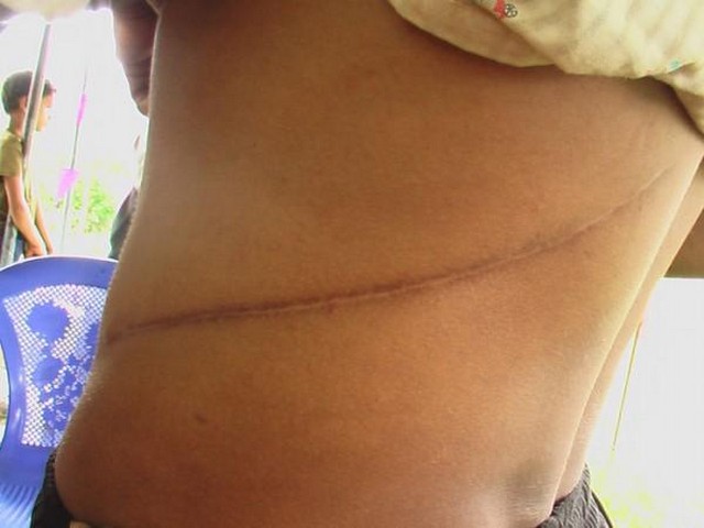 หมู่บ้านขายไต หมู่บ้านขายไต