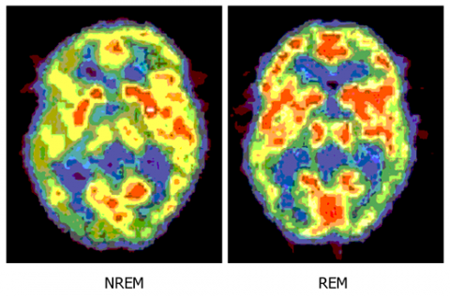 10 ความอัศจรรย์ชวนรู้ของสมองที่คุณต้องทึ่ง 10 ความอัศจรรย์ชวนรู้ของสมองที่คุณต้องทึ่ง